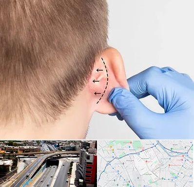 عمل زیبایی گوش در ستارخان شیراز