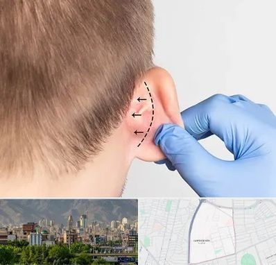عمل زیبایی گوش در جمشیدیه