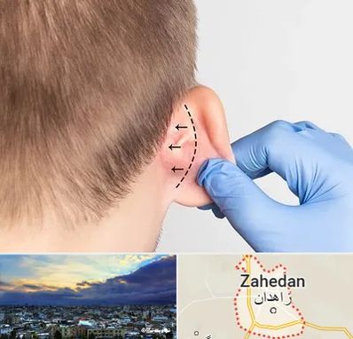 عمل زیبایی گوش در زاهدان