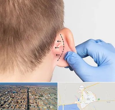 عمل زیبایی گوش در بندر ماهشهر
