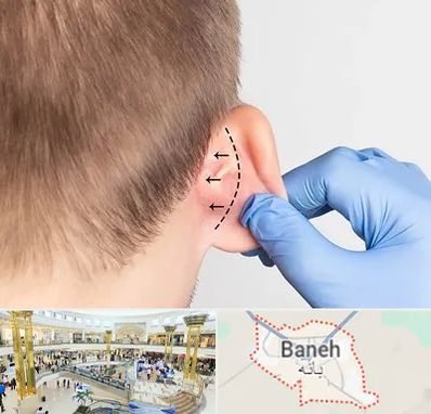 عمل زیبایی گوش در بانه