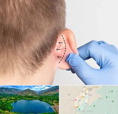 عمل زیبایی گوش در رودبار