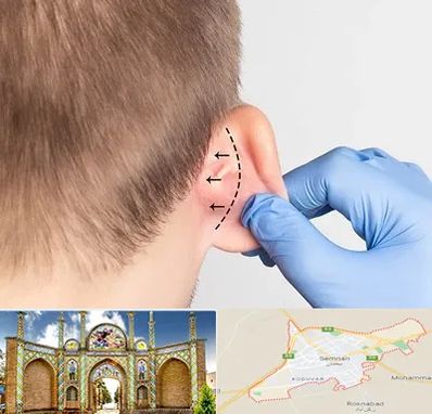 عمل زیبایی گوش در سمنان