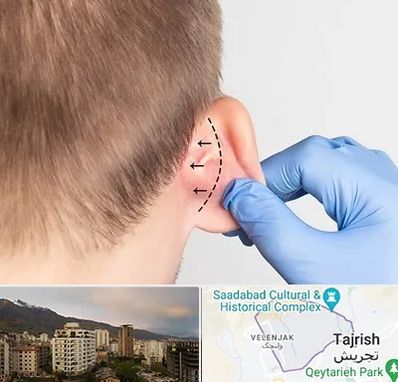 عمل زیبایی گوش در زعفرانیه