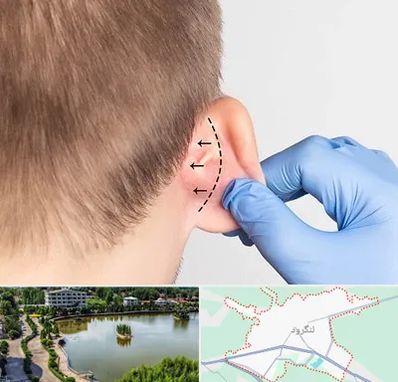 عمل زیبایی گوش در لنگرود