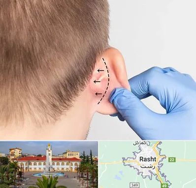 عمل زیبایی گوش در رشت