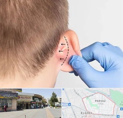 عمل زیبایی گوش در پرواز تبریز