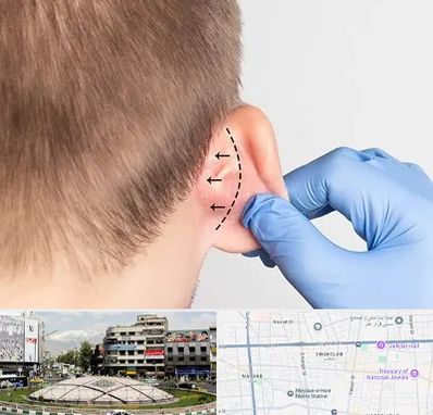 عمل زیبایی گوش در مرکز تهران