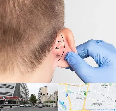 عمل زیبایی گوش در بلوار فردوس