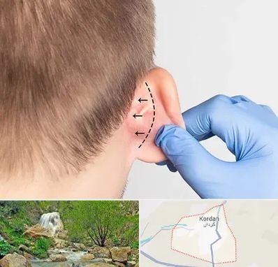 عمل زیبایی گوش در کردان