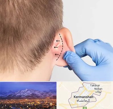 عمل زیبایی گوش در کرمانشاه