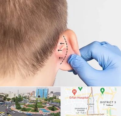 عمل زیبایی گوش در ونک تهران