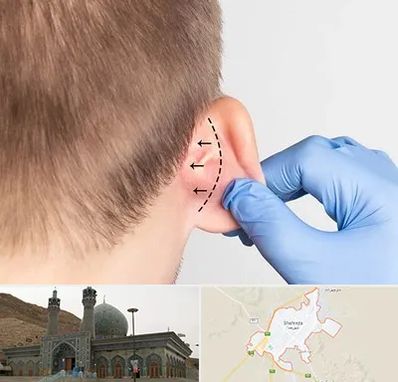 عمل زیبایی گوش در شهرضا