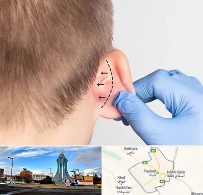 عمل زیبایی گوش در تایباد