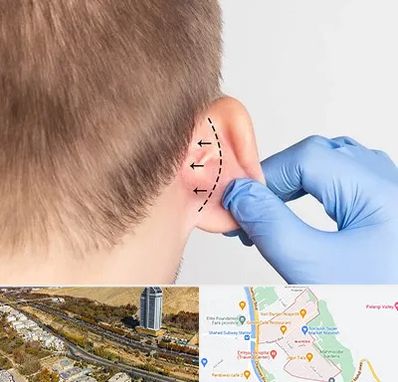 عمل زیبایی گوش در خیابان نیایش شیراز