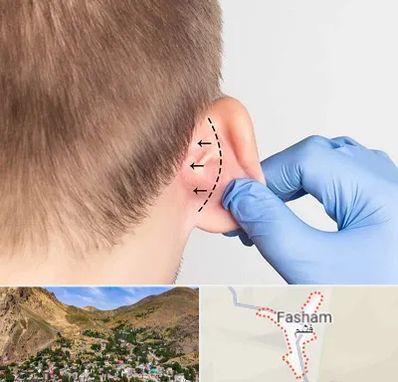 عمل زیبایی گوش در فشم