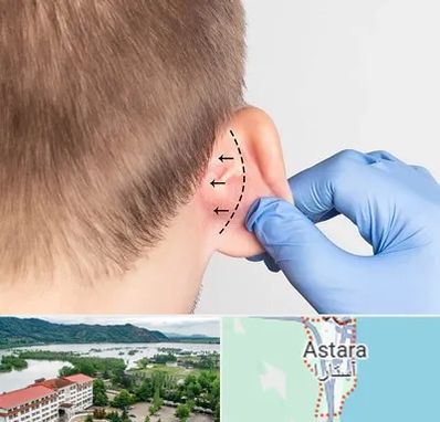 عمل زیبایی گوش در آستارا