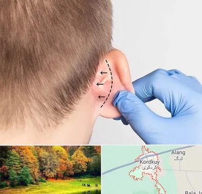 عمل زیبایی گوش در کردکوی