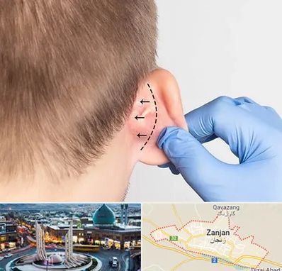 عمل زیبایی گوش در زنجان