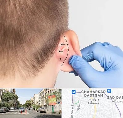 عمل زیبایی گوش در چهارصد دستگاه