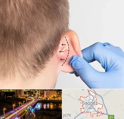 عمل زیبایی گوش در سقز