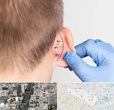 عمل زیبایی گوش در منطقه 18 تهران