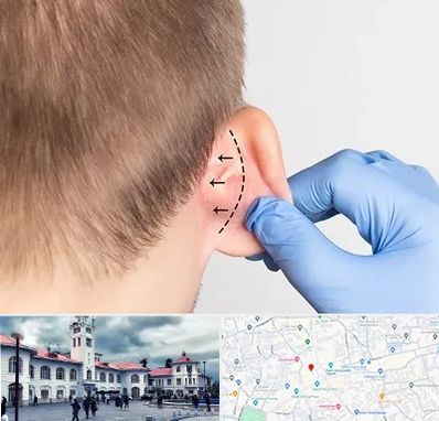 عمل زیبایی گوش در میدان شهرداری رشت