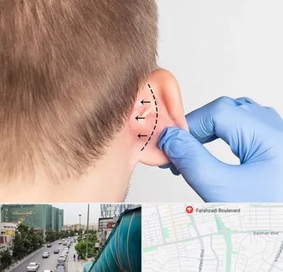 عمل زیبایی گوش در بلوار فرحزادی