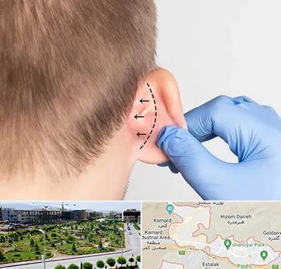 عمل زیبایی گوش در پردیس