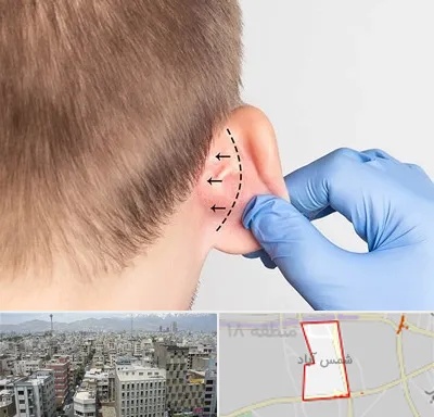 عمل زیبایی گوش در شمس آباد تهران