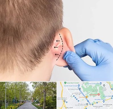 عمل زیبایی گوش در قدوسی غربی شیراز