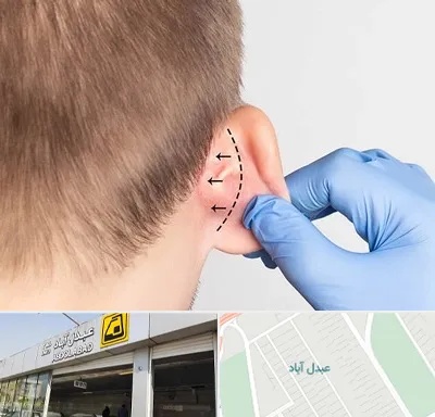 عمل زیبایی گوش در عبدل آباد