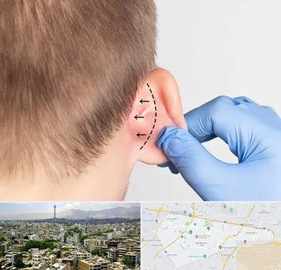 عمل زیبایی گوش در منطقه 8 تهران