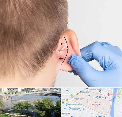 عمل زیبایی گوش در گلستان اهواز