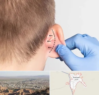 عمل زیبایی گوش در اسفراین