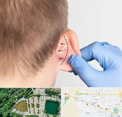 عمل زیبایی گوش در وکیل آباد مشهد