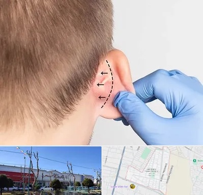 عمل زیبایی گوش در فاز دو اندیشه