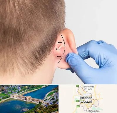 عمل زیبایی گوش در اصفهان