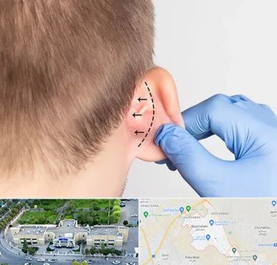 عمل زیبایی گوش در نسیم شهر