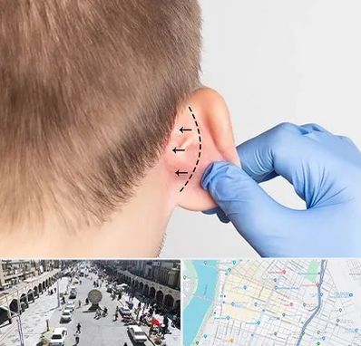 عمل زیبایی گوش در نادری اهواز