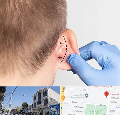 عمل زیبایی گوش در افسریه