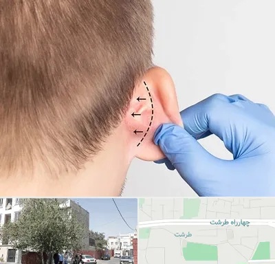 عمل زیبایی گوش در طرشت