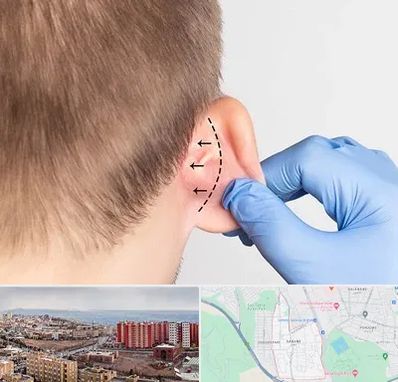 عمل زیبایی گوش در سهند تبریز