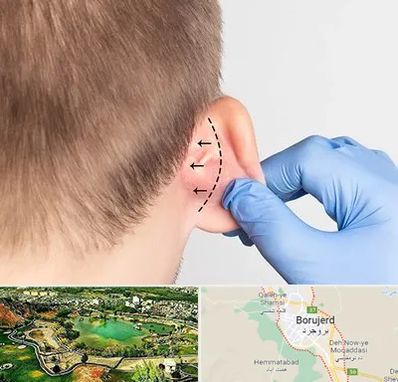 عمل زیبایی گوش در بروجرد