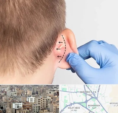 عمل زیبایی گوش در جنوب شرق تهران