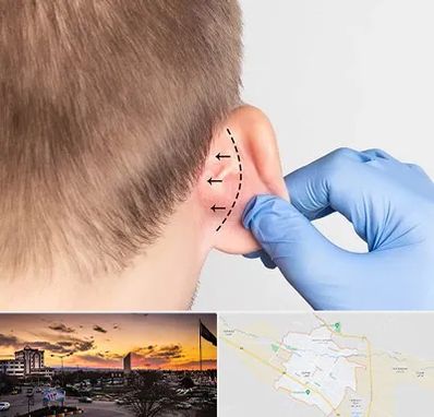 عمل زیبایی گوش در قوچان