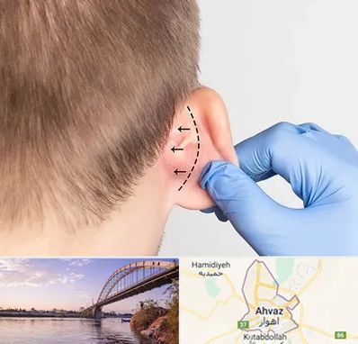 عمل زیبایی گوش در اهواز