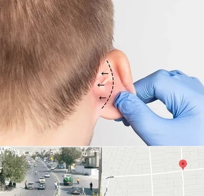 عمل زیبایی گوش در هاشمی