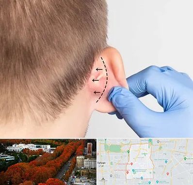 عمل زیبایی گوش در منطقه 6 تهران