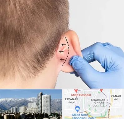 عمل زیبایی گوش در شهرک غرب تهران